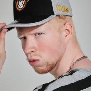 Modelo Italo Ravelle conquista mundo da moda ao dar visibilidade ao albinismo